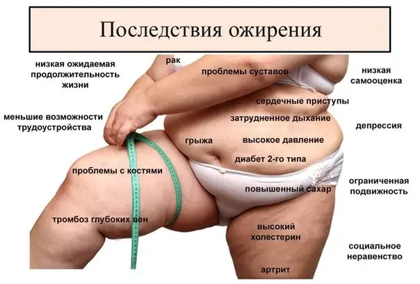 Здоровье: Чем опасно ожирение? Почему не стоит пихать в себя еду